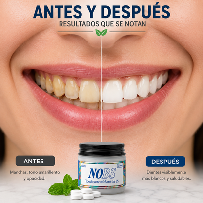 🦷 DentTabs NOBS | Tabletas Dentales Blanqueadoras