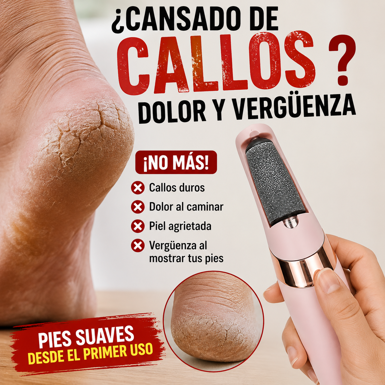 Removedor Electrico de Callos | Pies Suaves al Instante